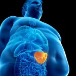 Obesity Lowers Immune Function as well as Increases Tumor Growth