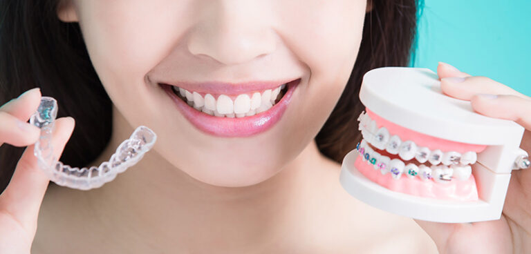 invisalign slide2 768x368