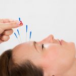 Going Under the Needle: Anti-aging Effects of Acupuncture