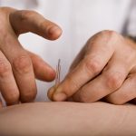Acupuncture: A Solution to the Opioid Crisis?