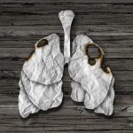 Vitamin B Supplements Could Increase Lung Cancer Risk in Smokers