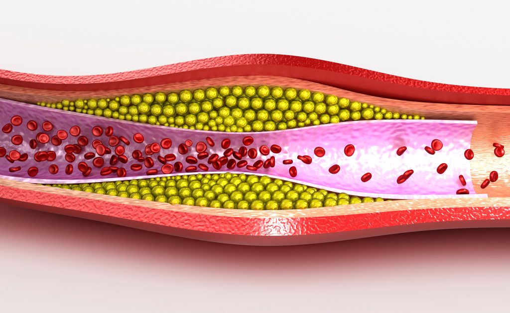 Hormone Therapy May Pose Cardiovascular Risk for Gender Transitioning Individuals