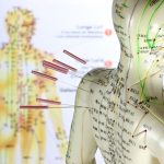 Acupuncture for Common Health Concerns