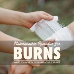 Naturopathic Remedies for Burns