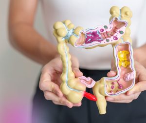 woman holding model of colon