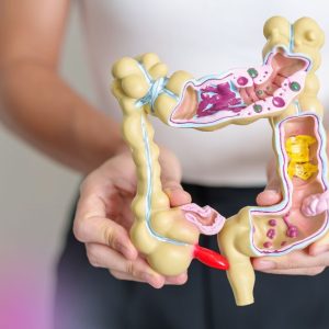 woman holding model of colon