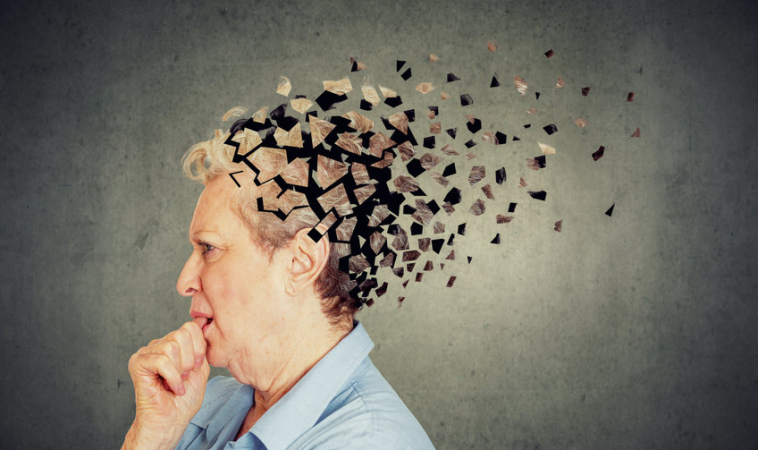 Alzheimer’s Disease Linked to Certain Personality Traits