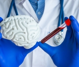 Cholesterol in Brain Regulates Alzheimer’s Plaquing