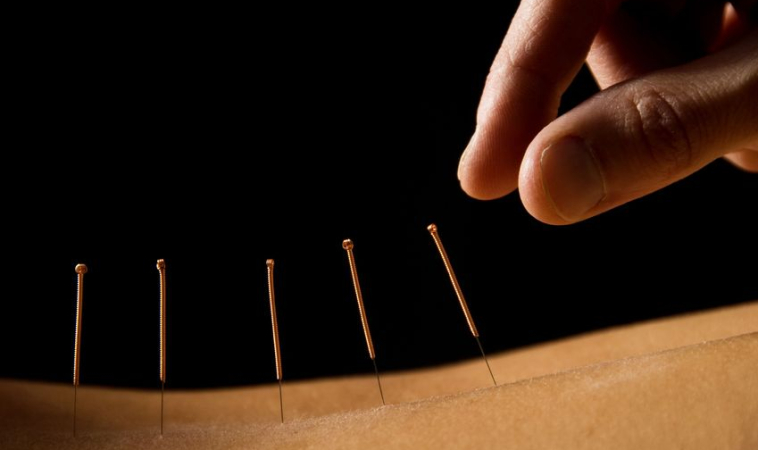 Acupuncture For Hypertension