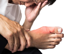 Gout: What’s it all About?!
