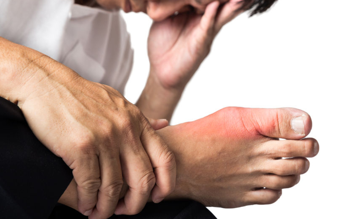 Gout: What’s it all About?!