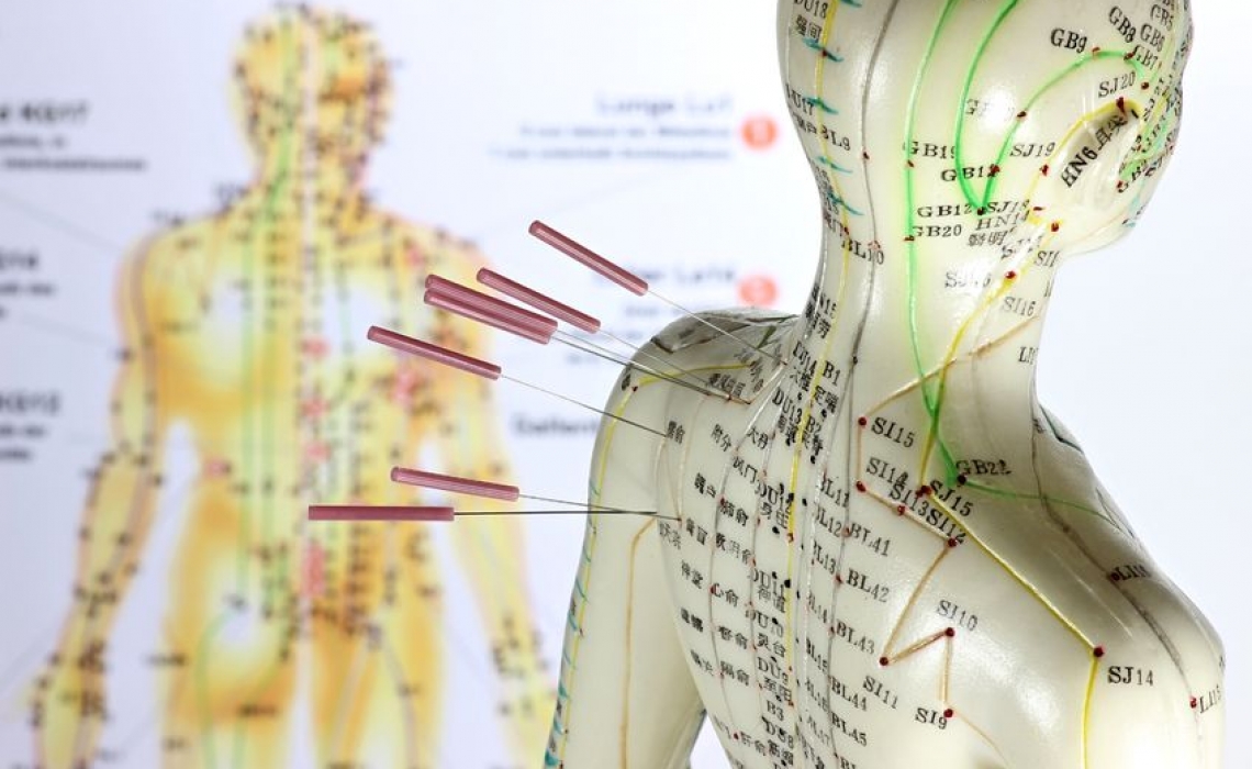 Acupuncture for Common Health Concerns