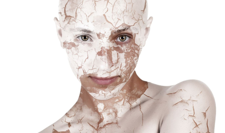 Dry Skin: 5 Ways to Get Rid of It!