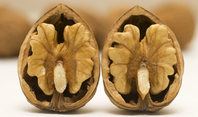Walnuts Can Benefit You Gastrointestinal Health