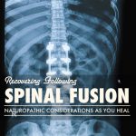 Recovering After Spinal Fusion